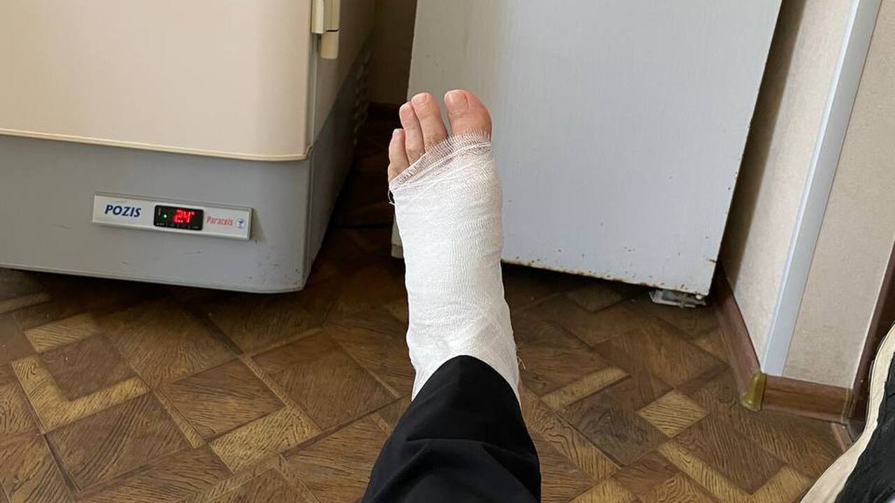 Глава Бугульмы Дамир Фаттахов, проткнув ногу рж...