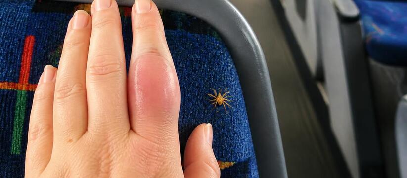 Россиянка попала в больницу после укуса ядовитого паука в автобусе В Татарстане 29-летняя пассажирка пригородного ...